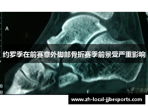 约罗季在前赛意外脚部骨折赛季前景受严重影响